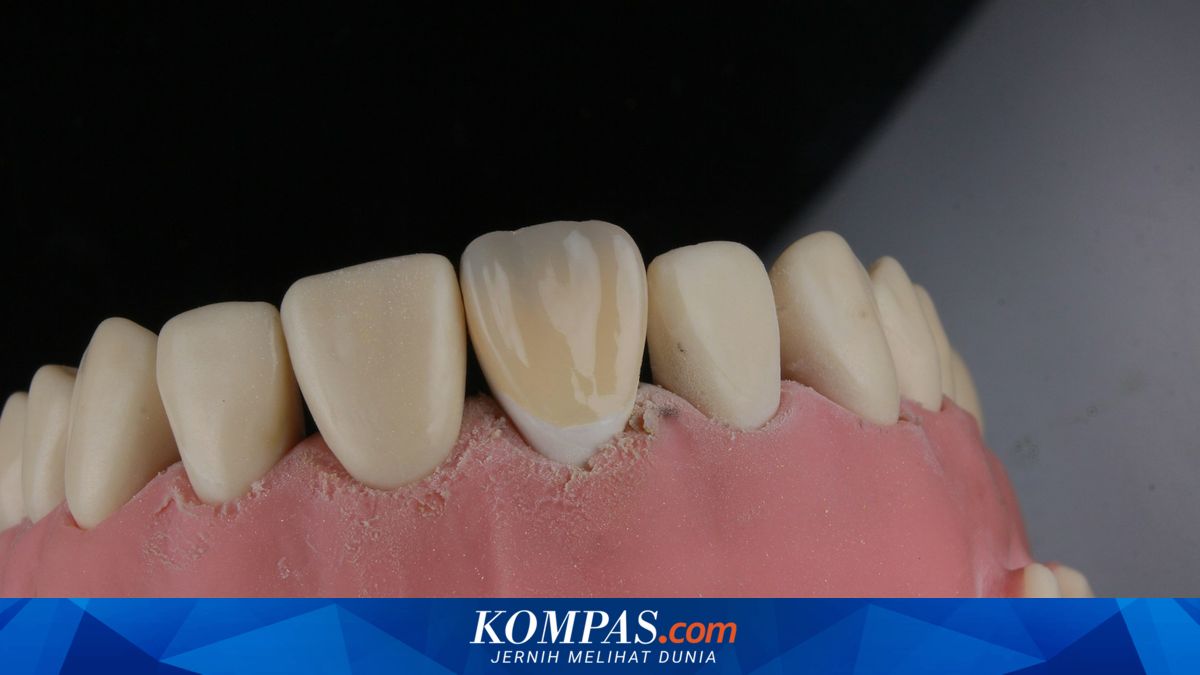 Enam Faktor yang Mengubah Warna Gigi Menjadi Tidak Seputih Dulu
