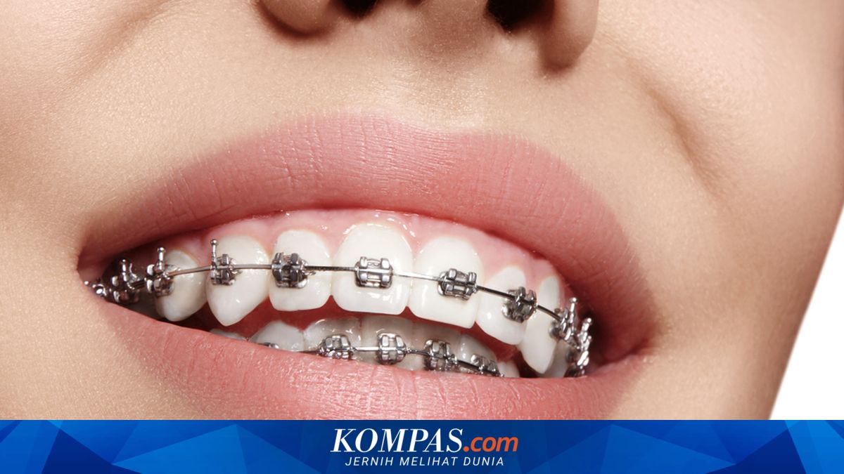 Fenomena "Iyup" di Kalangan Gen Z dan Penjelasan Dokter Gigi