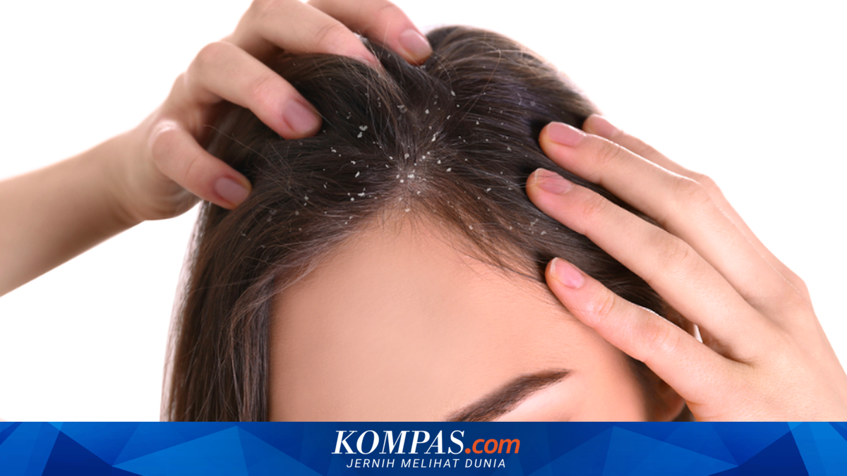 Mengapa Berhijab atau Menggunakan Helm Meningkatkan Risiko Ketombe?