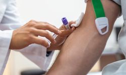 Pentingnya Pemeriksaan Kolesterol: Kewaspadaan Terhadap Risiko Tanpa Gejala