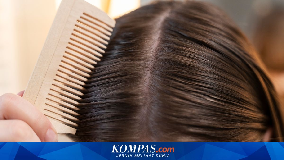 Penyebab Kulit Kepala Berminyak dan Rambut Lepek yang Perlu Diketahui