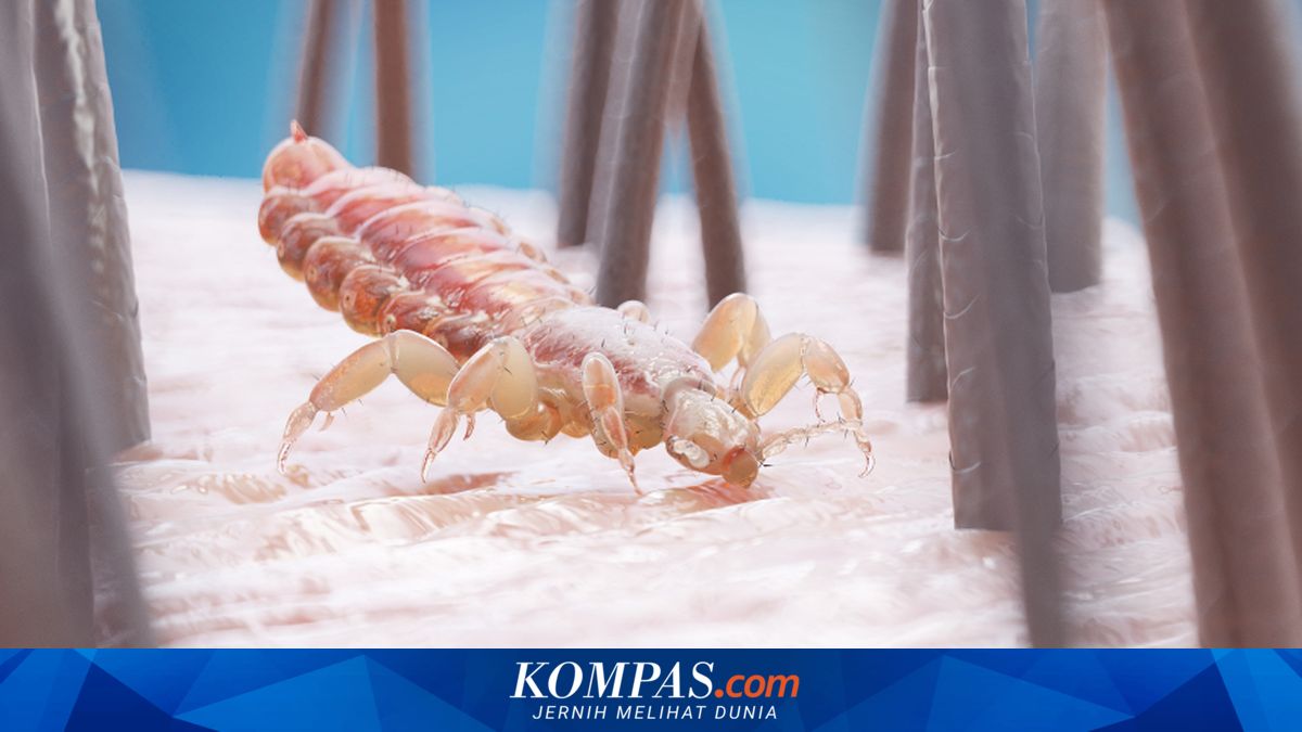 Waspadai Kutu Rambut pada Anak, Dampaknya Bisa Mengganggu Tidur dan Menyebabkan Stres